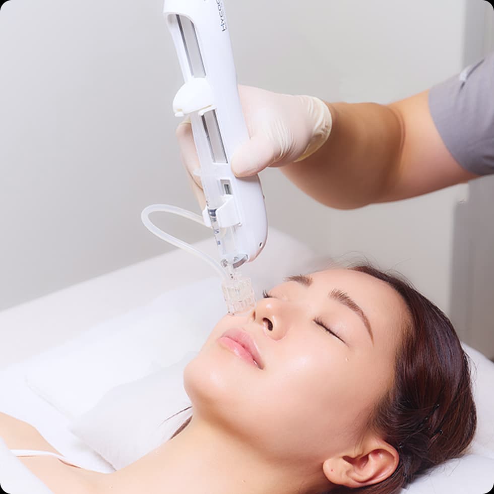 정교하고 균일한 시술