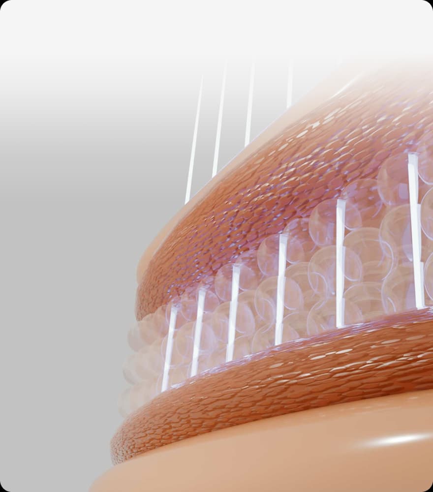 트리클 카드 배경