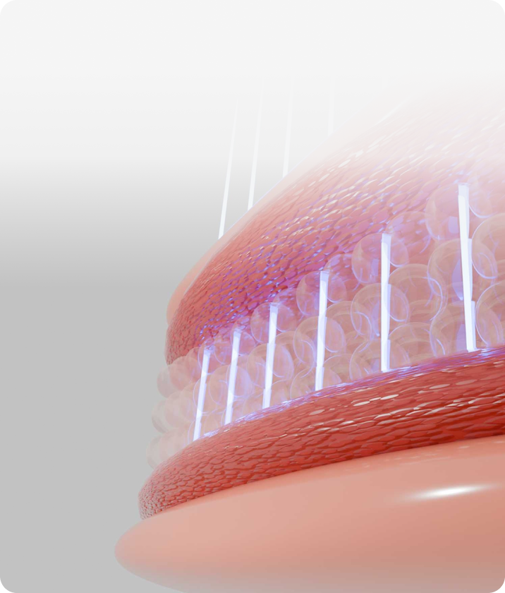 트리클 카드 배경