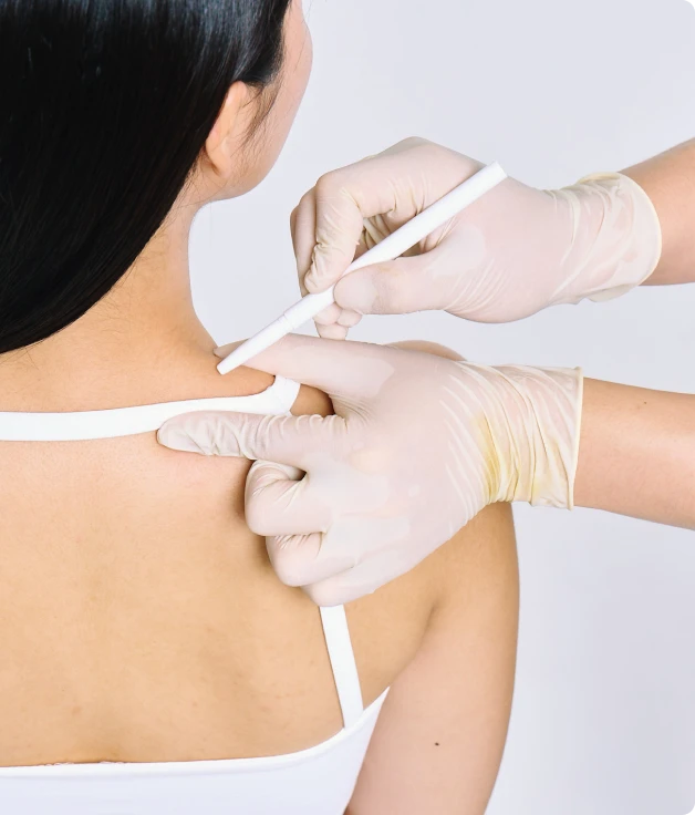 맞춤 시술 이미지 1