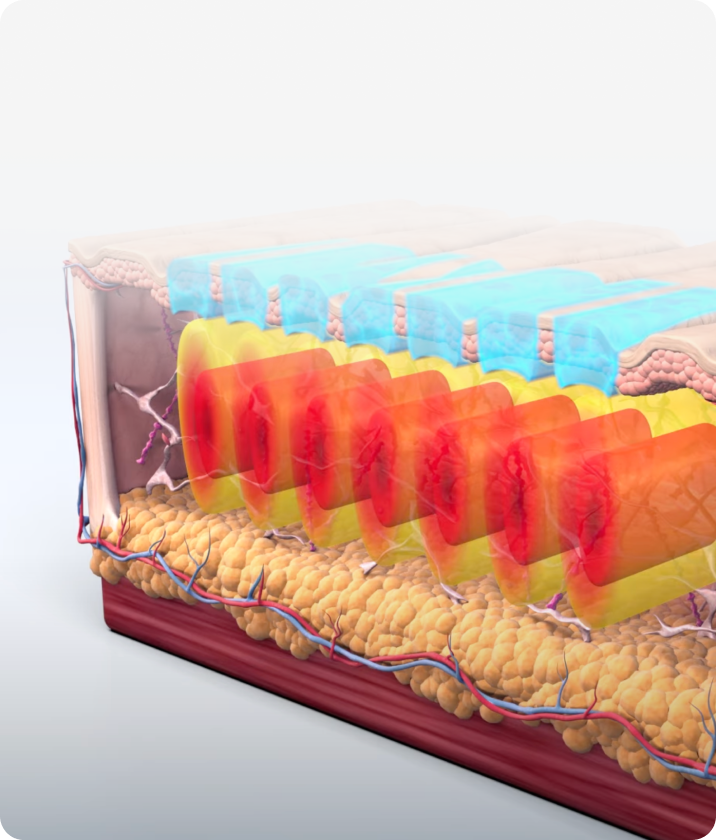 트리클 카드 배경